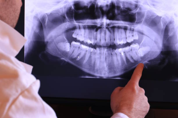 Best Emergency Dentist for Knocked-Out Tooth in Manassas, VA