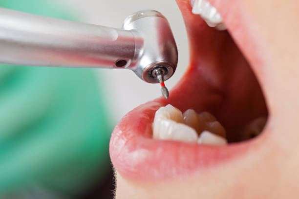 Best Emergency Cosmetic Dentistry in Manassas, VA